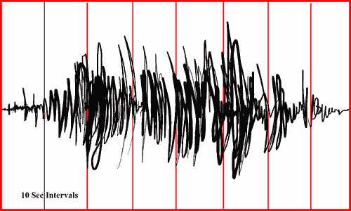 a complex minute-long EEG spindle. Dream sketch by Wayan